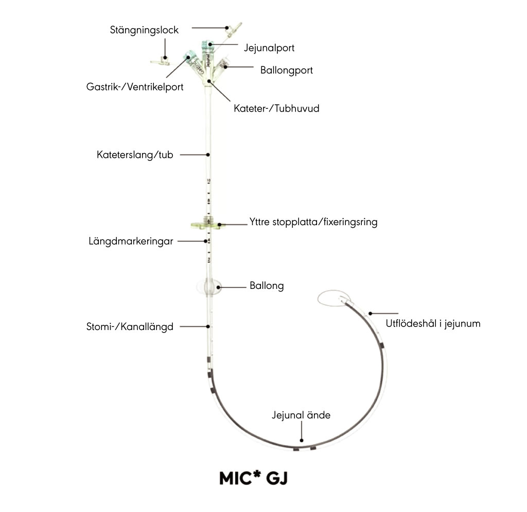 MIC* Gastro-jejunal Feeding Tube